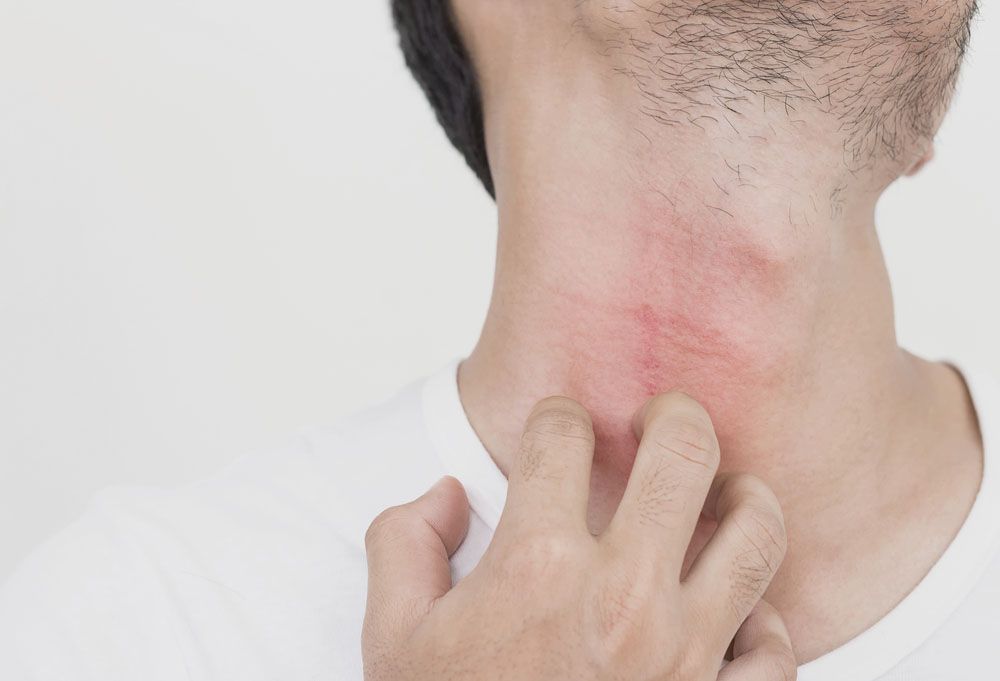 상해미수(소년범죄) 범행 목적 있었지만 1호 보호처분